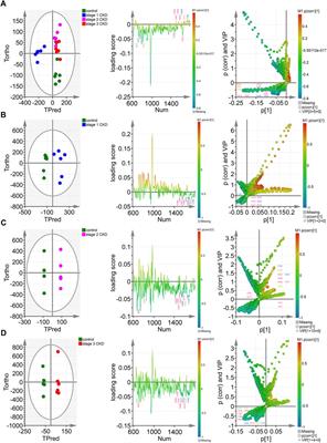 Rapid identification of early renal damage in asymptomatic hyperuricemia patients based on urine Raman spectroscopy and bioinformatics analysis